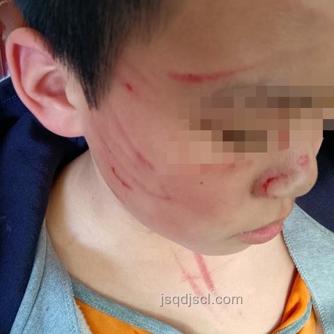 醉酒男子電梯內(nèi)撕扯女孩頭發(fā)事件深度分析 醉酒男子電梯內(nèi)撕扯女孩頭發(fā)事件深度分析
