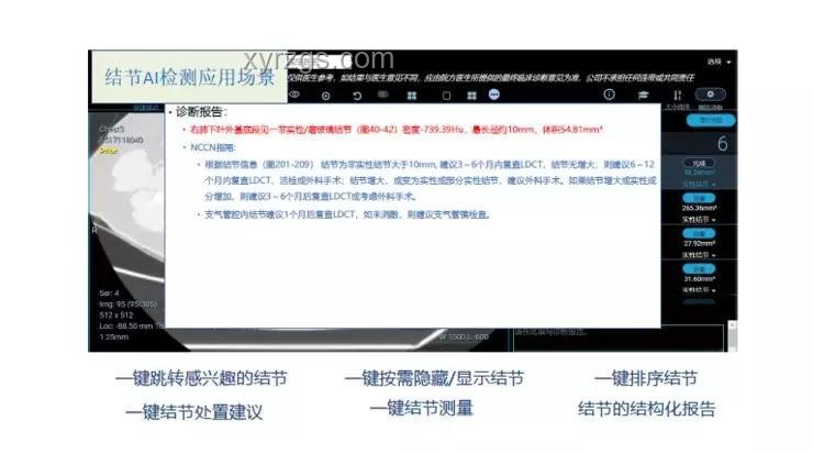 AI驅(qū)動(dòng)的醫(yī)療影像診斷革新 AI驅(qū)動(dòng)的醫(yī)療影像診斷革新