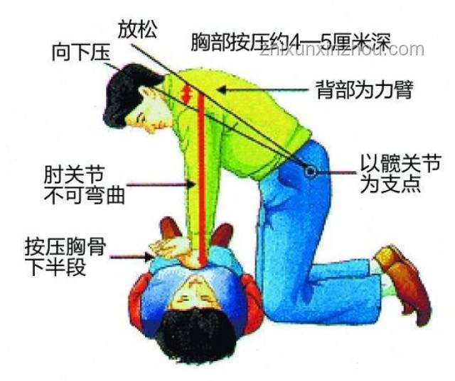 世界冠軍突發(fā)暈倒急救與預防指南 ??,暈厥,急救措施,健康監(jiān)測,預防措施